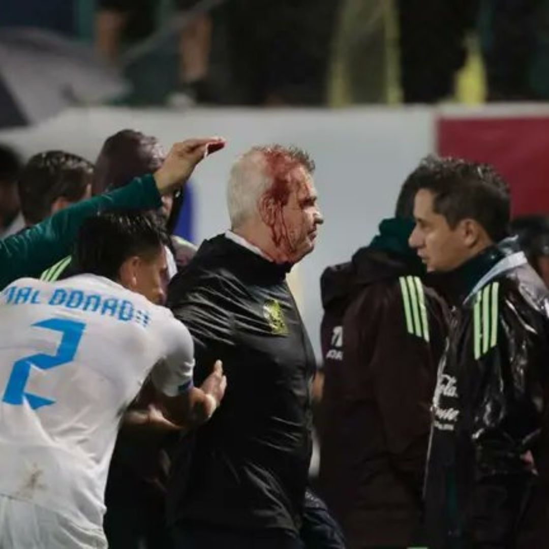 Javier Aguirre, técnico mexicano, fue descalabrado el viernes en el estadio Francisco Morazán, de San Pedro Sula.