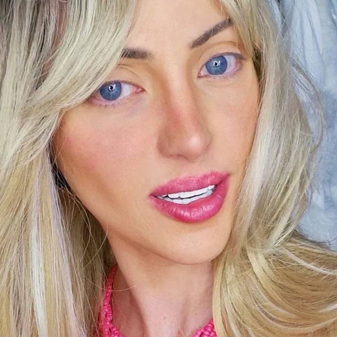 De que murio la Barbie humana