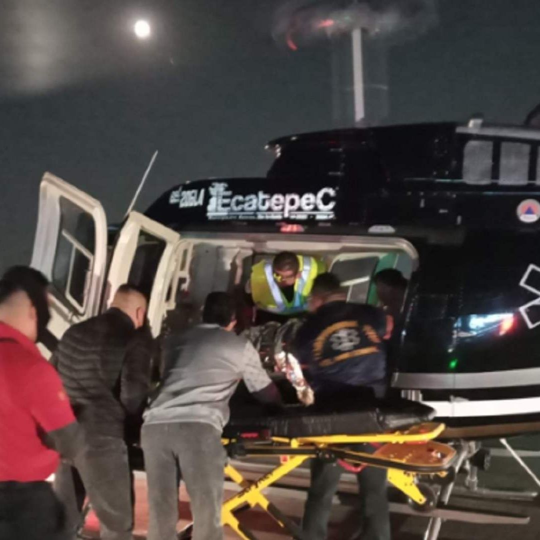 Traslado de mujer quemada con gasolina