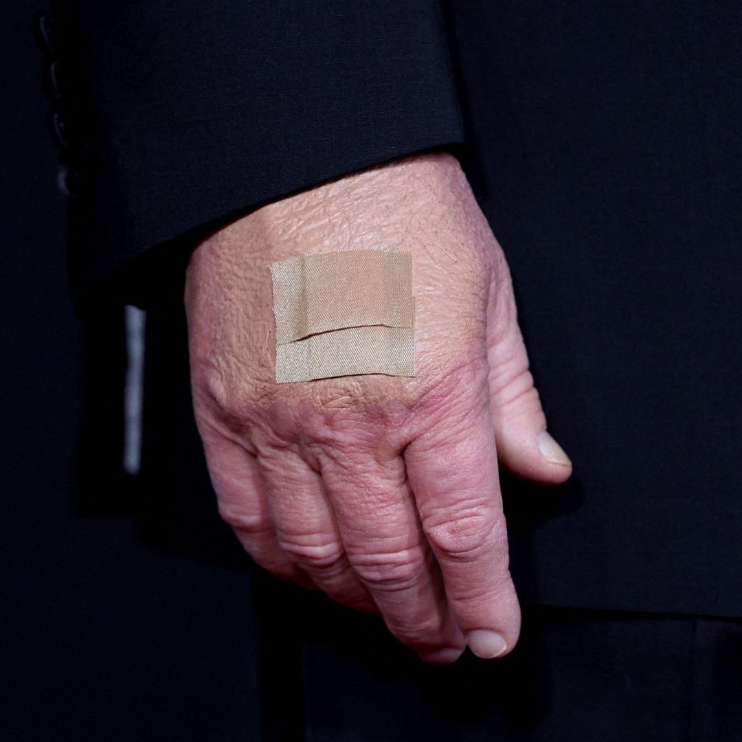 ¿Qué Le Pasó a Donald Trump que Tiene la Mano con Venda Adhesiva? Esto Dice la Casa Blanca