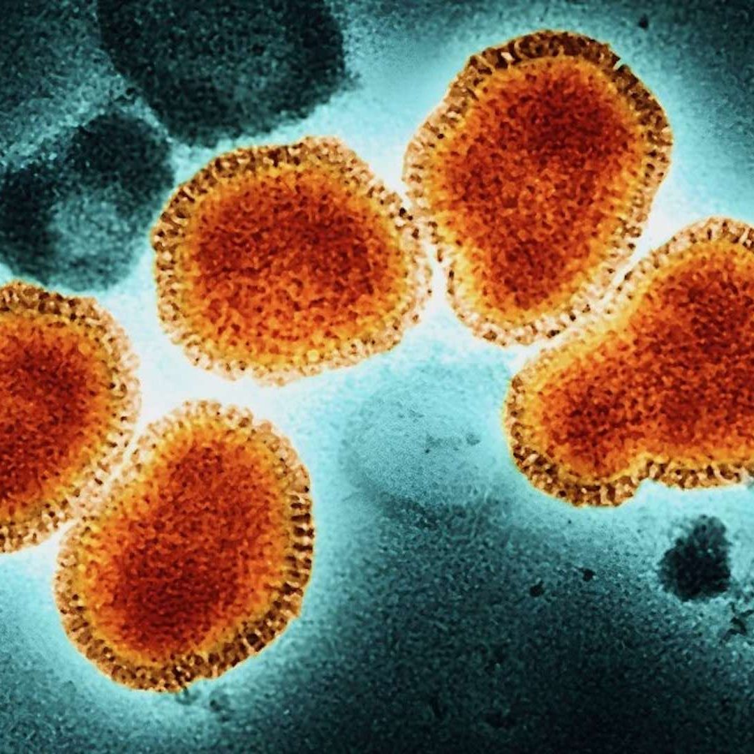 Virus H3N2 bajo el microscopio