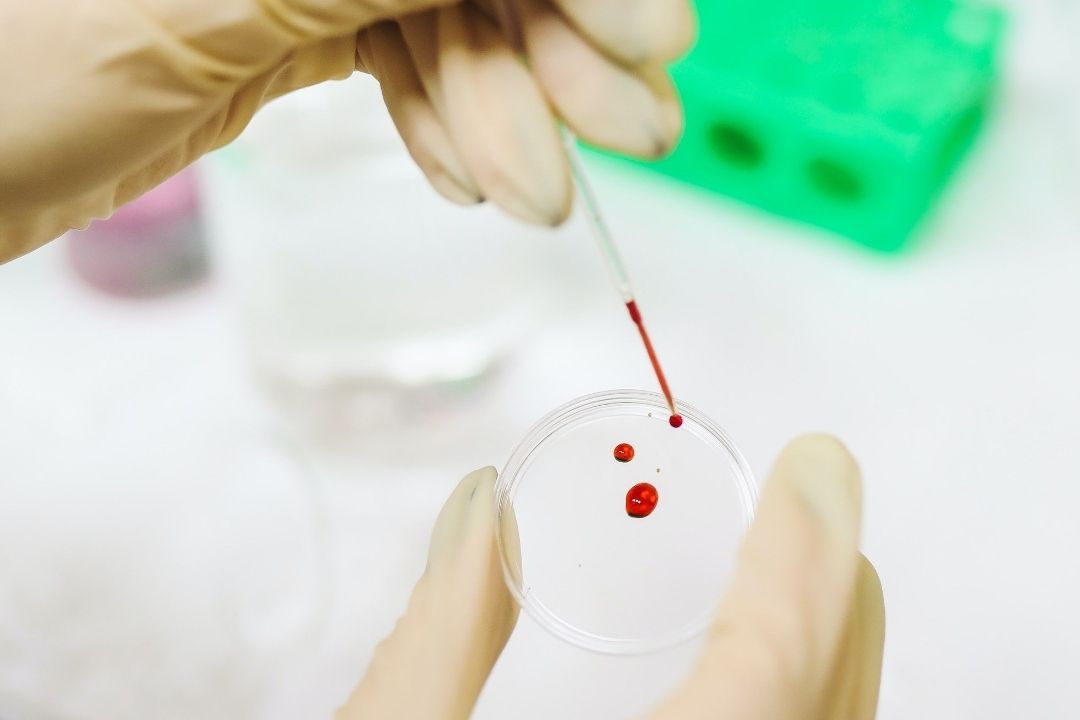 Cáncer: Crean Método Para Detectar la Enfermedad en Menos de Tres Horas y a Bajo Costo