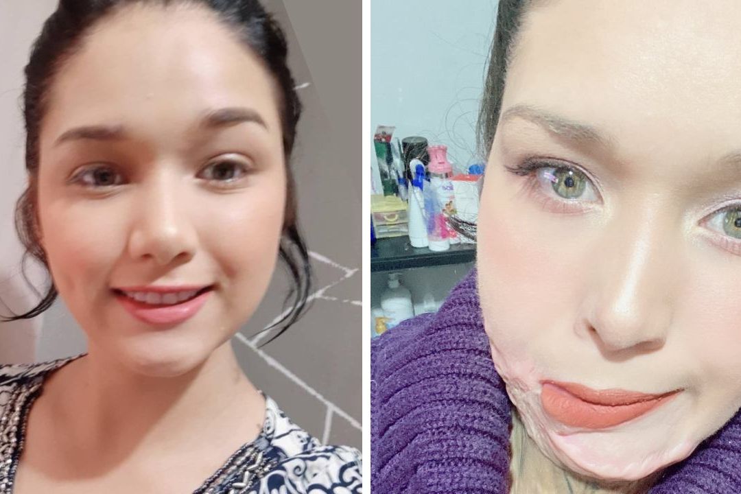 Qué ha pasado con Liliana Torres, sobreviviente de feminicidio en Nuevo León.