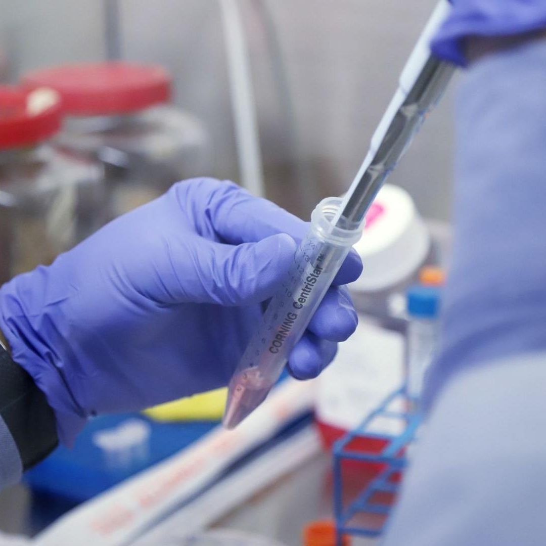 ¿Qué Afecta la Supervivencia de Pacientes con Cáncer de Ovario?