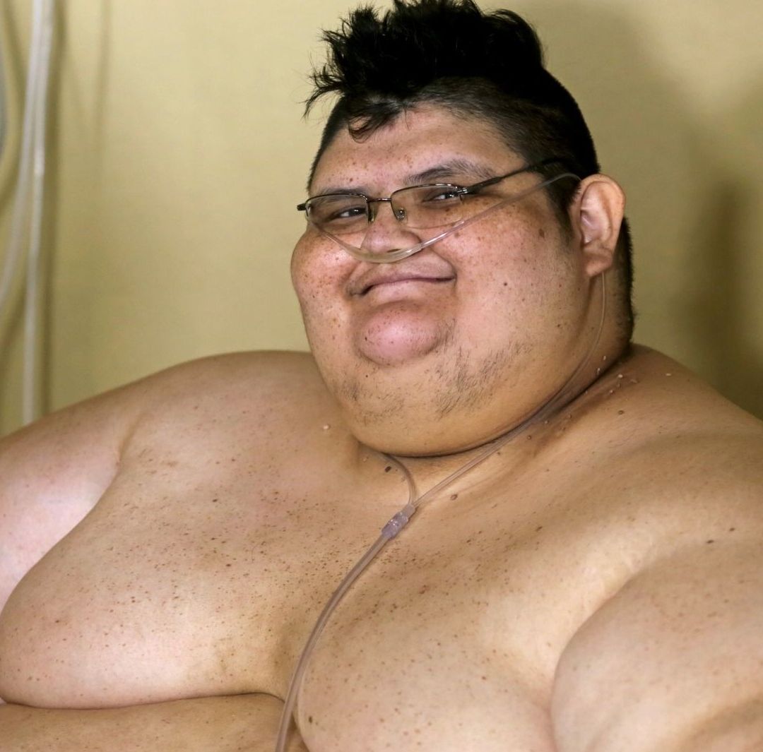 Muere Juan Pedro Franco, Mexicano con Récord Guinness por Ser el Hombre Más Obeso del Mundo: ¿Quién Fue?