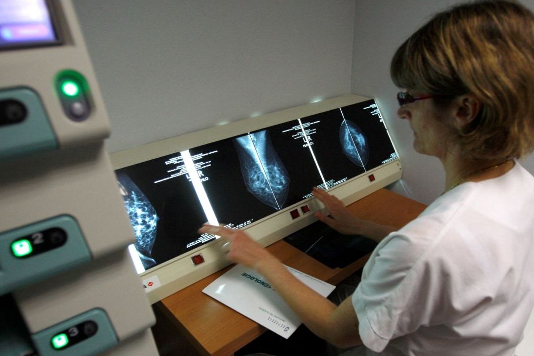 Identifican pieza del ‘rompecabezas’ del cáncer de mama que explicaría ciertos tipos