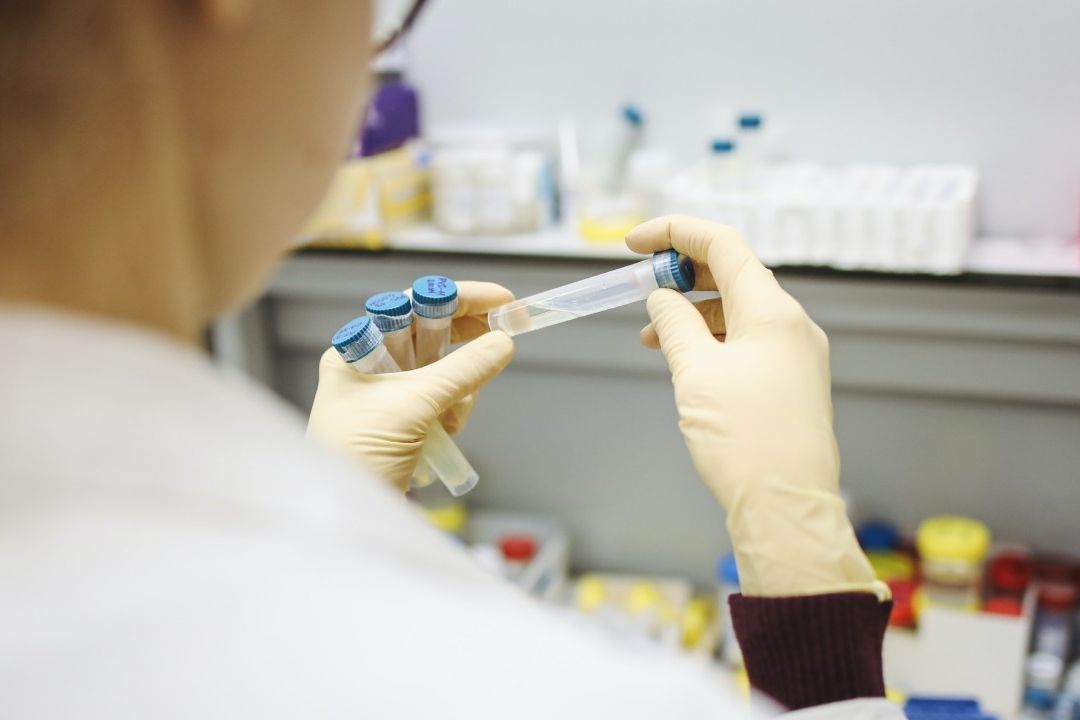 Los científicos analizaron muestras de sangre de más de 700 pacientes con esclerosis múltiple y de otras tantas sanas.