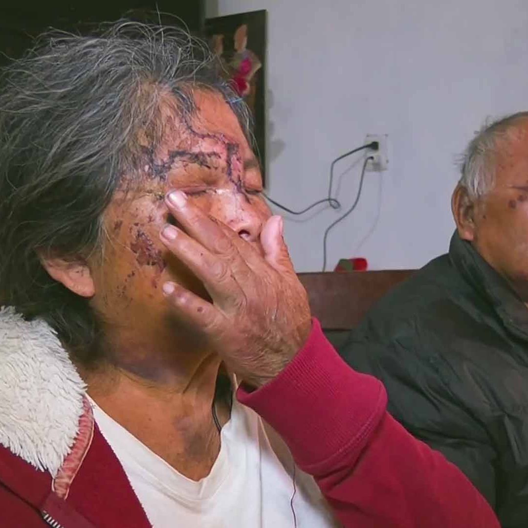 Pareja de abuelitos atacada en Oaxaca