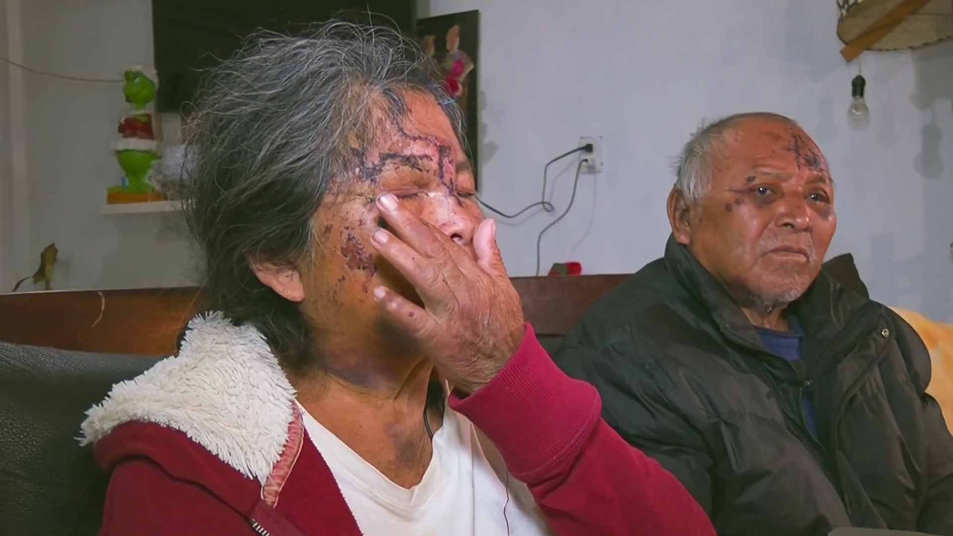 Pareja de abuelitos atacada en Oaxaca