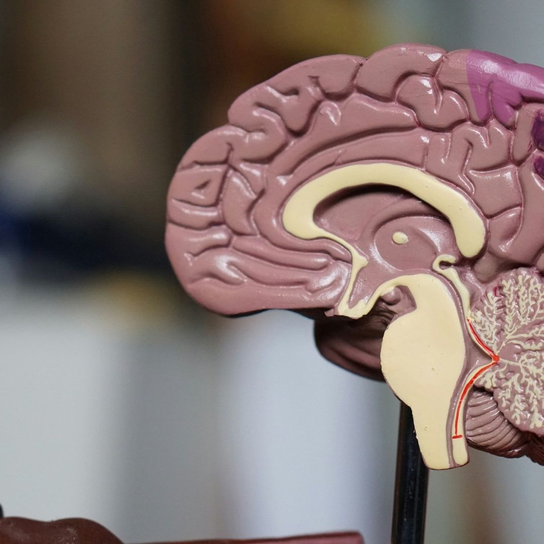 Alzheimer Enfermedad