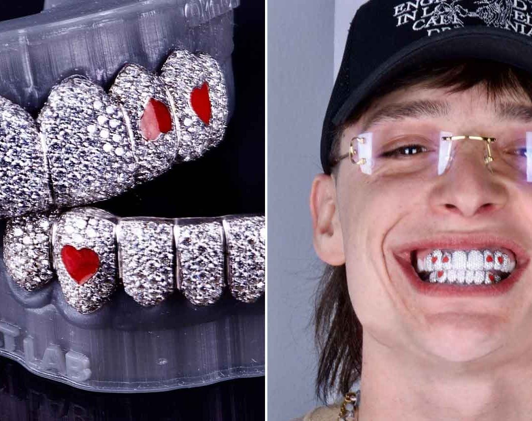 Peso Pluma: ¿Cuánto Cuesta Su Nueva Dentadura de Diamantes?