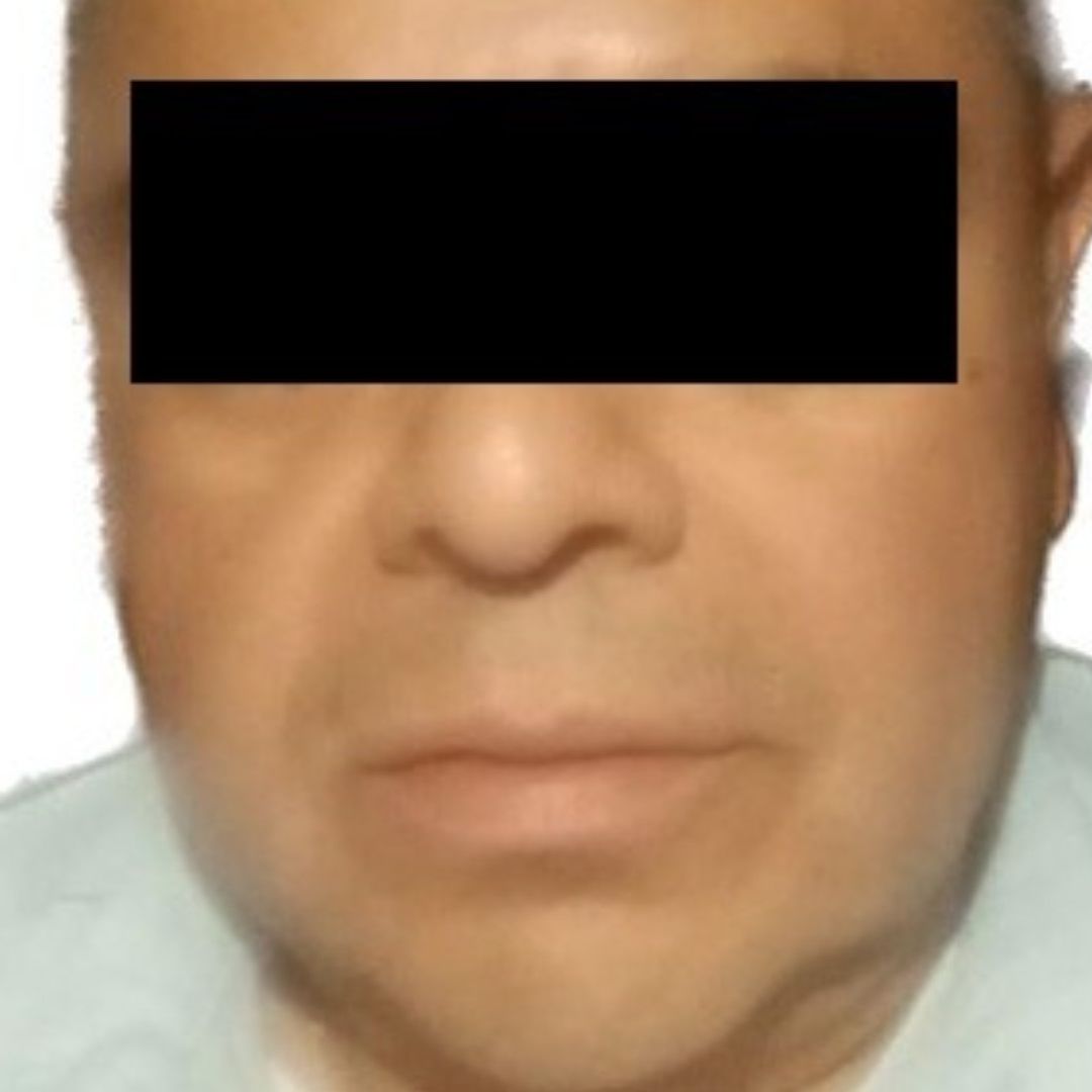 Detenido acusado de matar a gato en Tlalnepantla