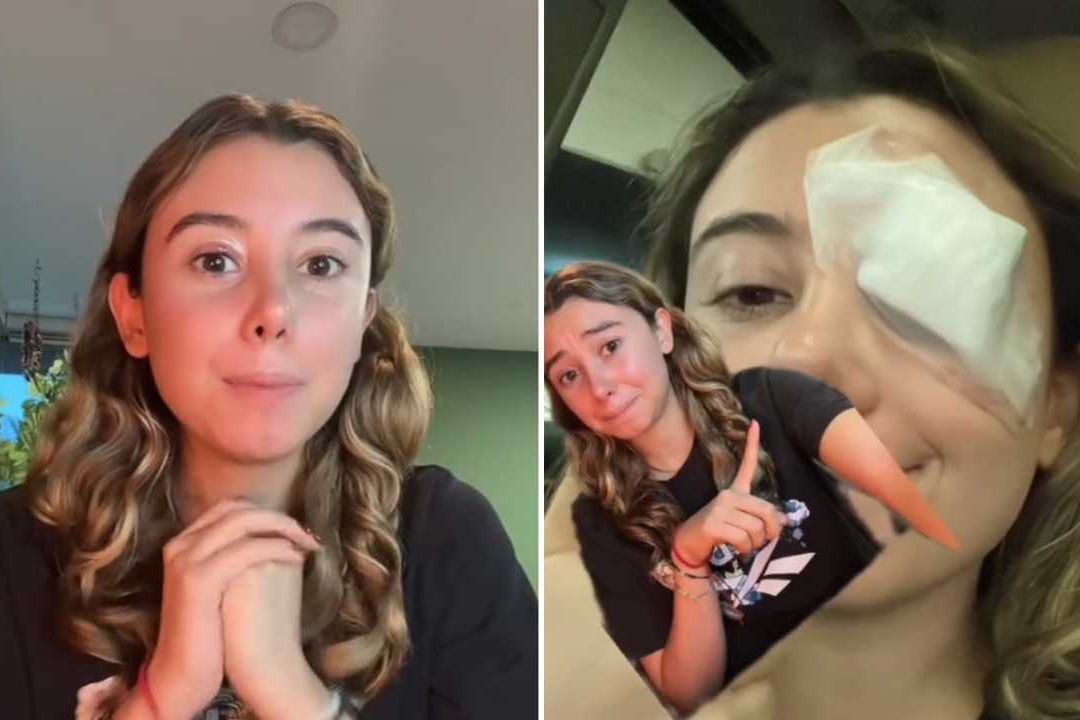 Operan a joven del ojo por seguir consejo de belleza de TikTok