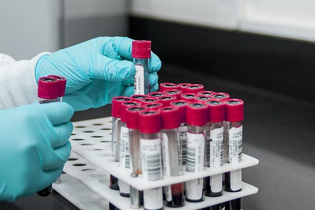 SFP revela colusión de 19 empresas para obtener y repartirse licitaciones en sector salud