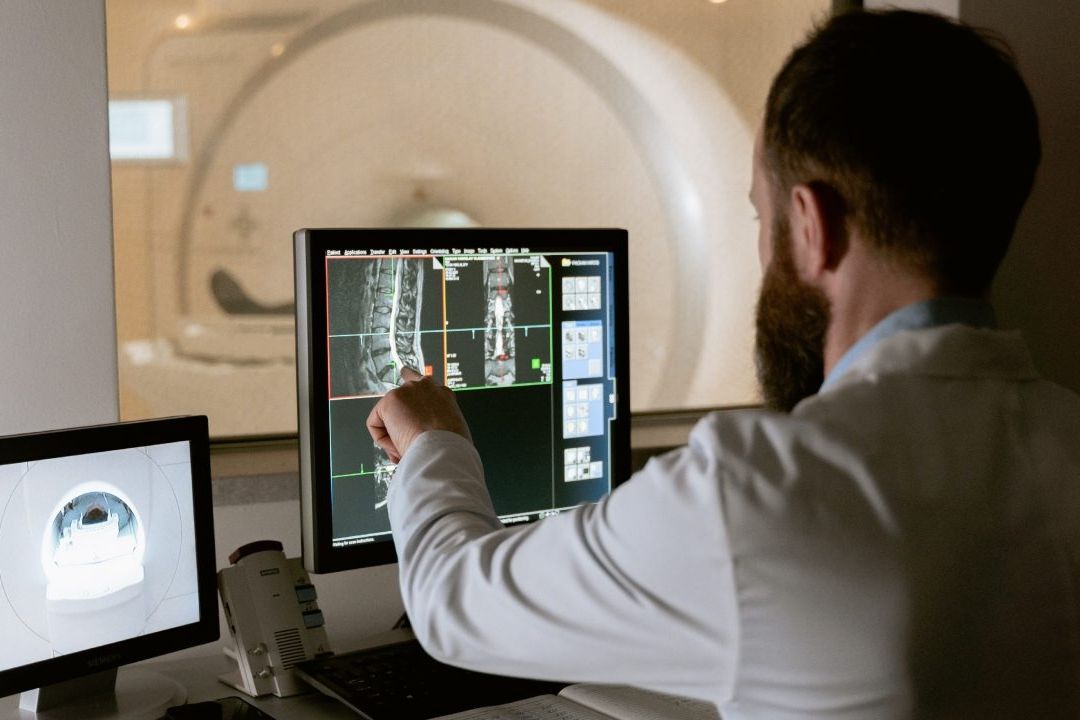 Un estudio relevó que los pacientes con esclerosis múltiple que reciben tratamiento en los primeros síntomas reducen el riesgo de discapacidad