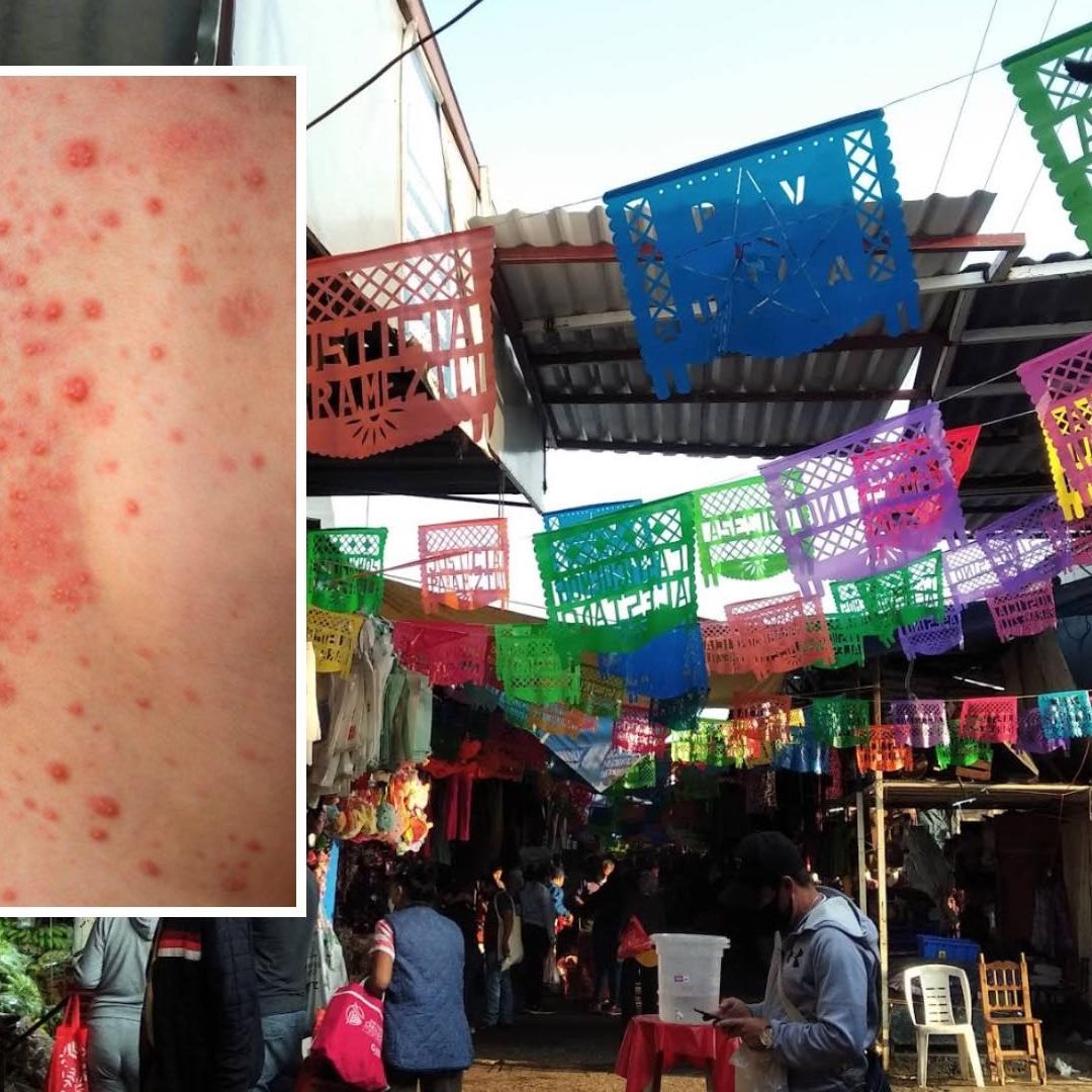 Brote de Sarampión en Mercado Hidalgo Puebla Jornada de Vacunación Vacunas Gratis 2026