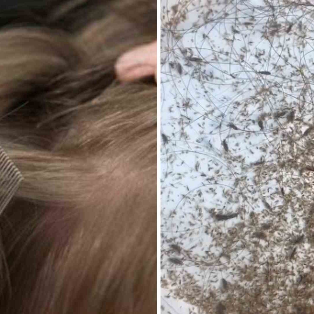 Madre Vegana No Mata los Piojos de su Hija para No Dañarlos