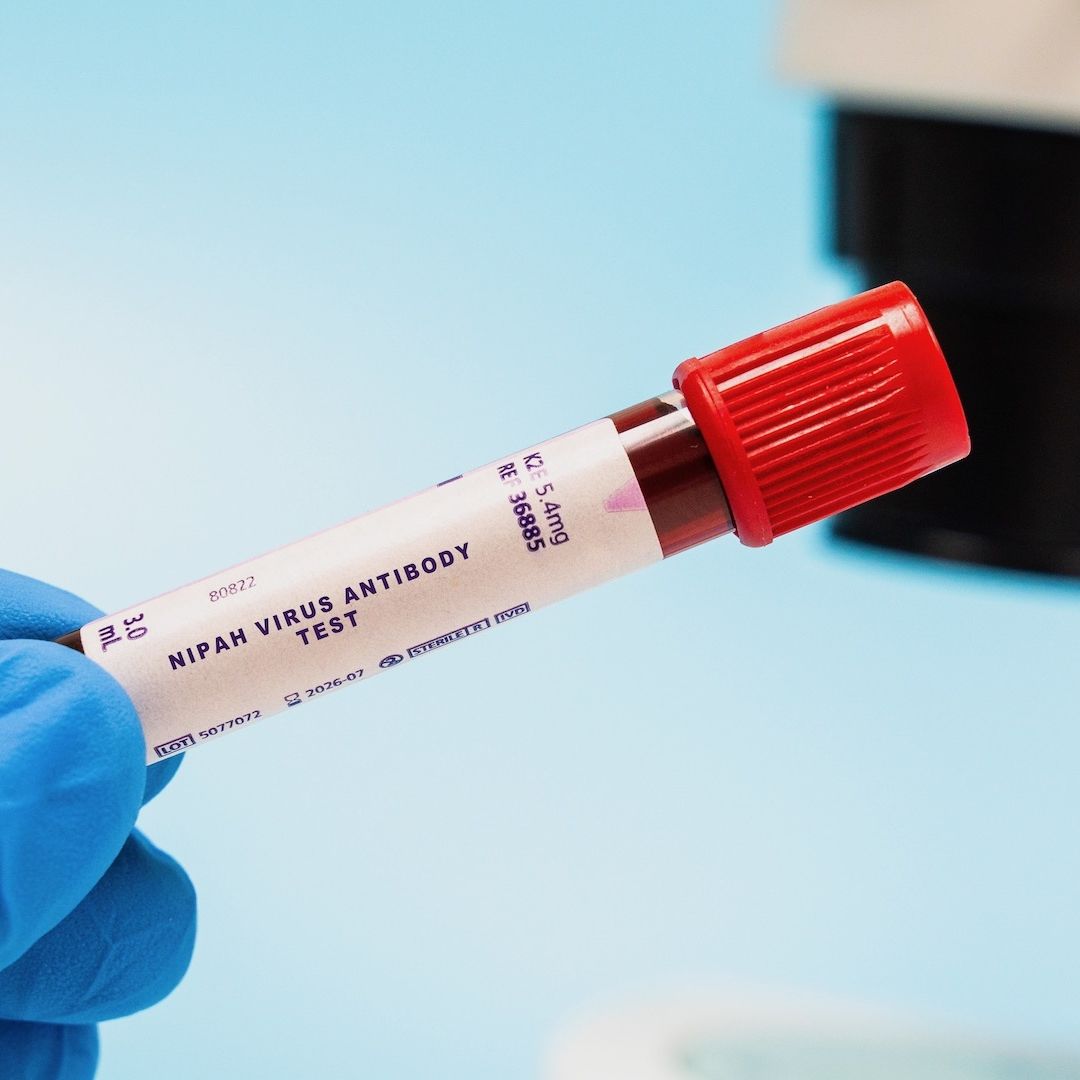 Emiten alerta por virus Nipah en la India, ¿se contagia entre humanos?