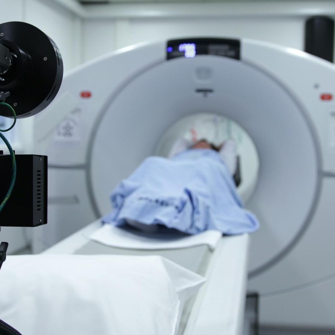Lombriz Intestinal es Extraída Viva del Cerebro de una Mujer