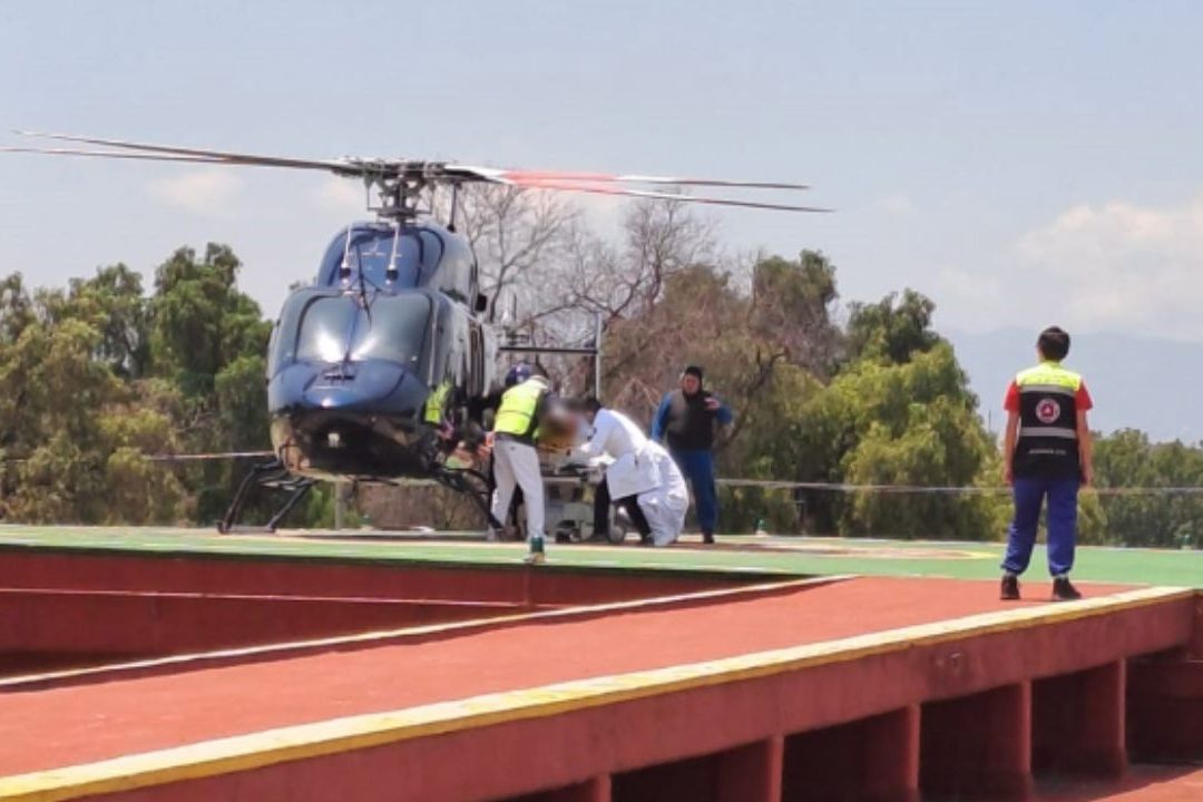Víbora Escondida en Clóset Muerde a Niña en Xochimilco