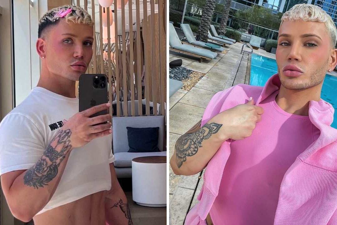 Cory Hall es un influencer de 29 años apodado el "Ken Kardashian" porque gastó 100 mil dólares para parecerse a la empresaria