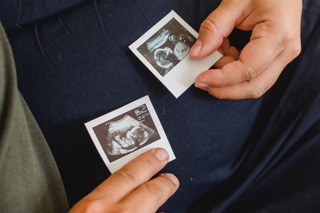 Pareja Acude por Cesárea y Médicos les Dicen que Tenía Tumores
