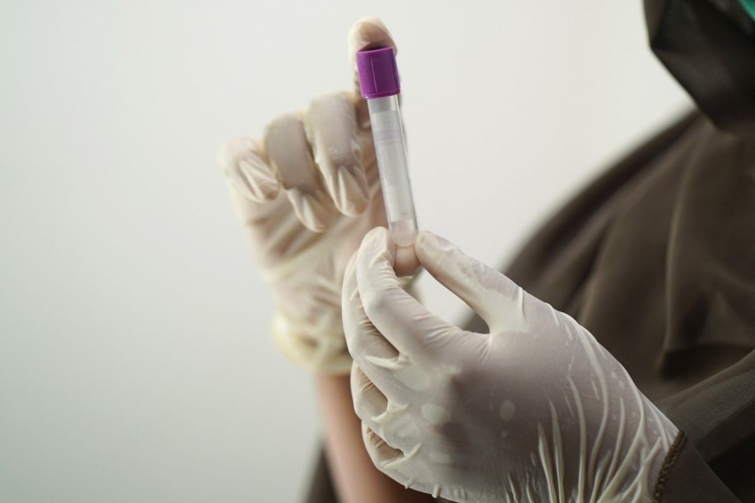 Virus Nipah, ¿nueva amenaza para la humanidad?