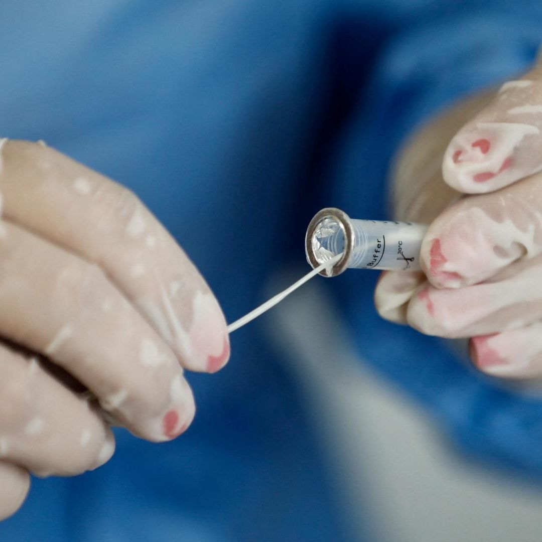 Personal de salud toma una muestra para analizar posible COVID-19 en paciente, en enero de 2022.