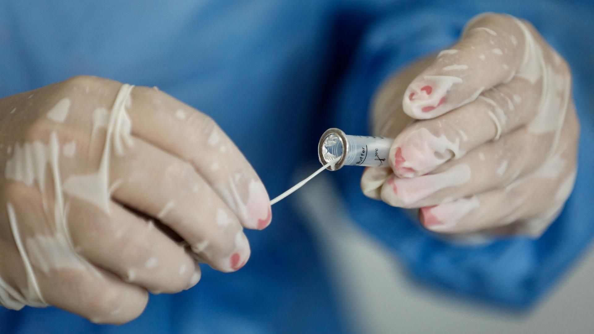 Personal de salud toma una muestra para analizar posible COVID-19 en paciente, en enero de 2022.