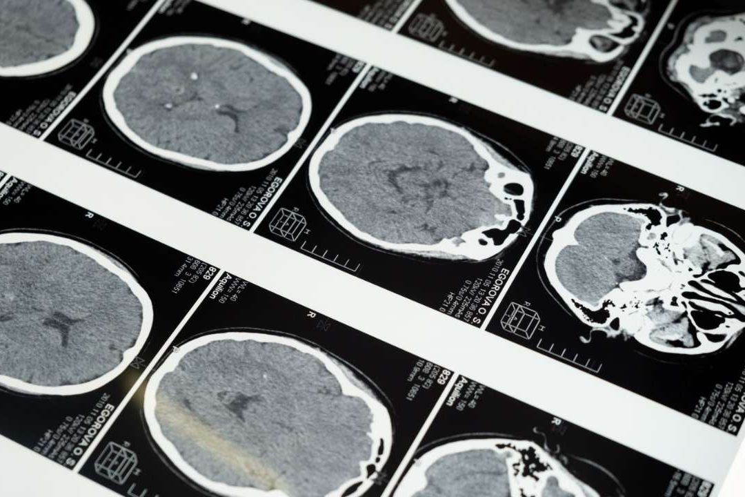 Música de Pink Floyd, protagonista en estudio de impacto cerebral