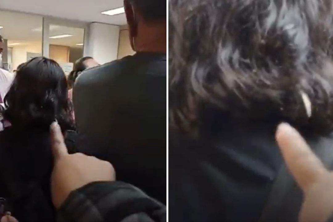 Encuentran chinche en pelo de alumna de Ciencias Políticas de la UNAM