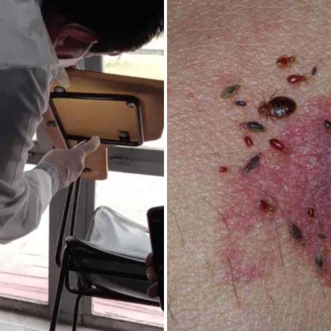 ¿Alerta Sanitaria por Chinches en CDMX? Esto Dicen las Autoridades