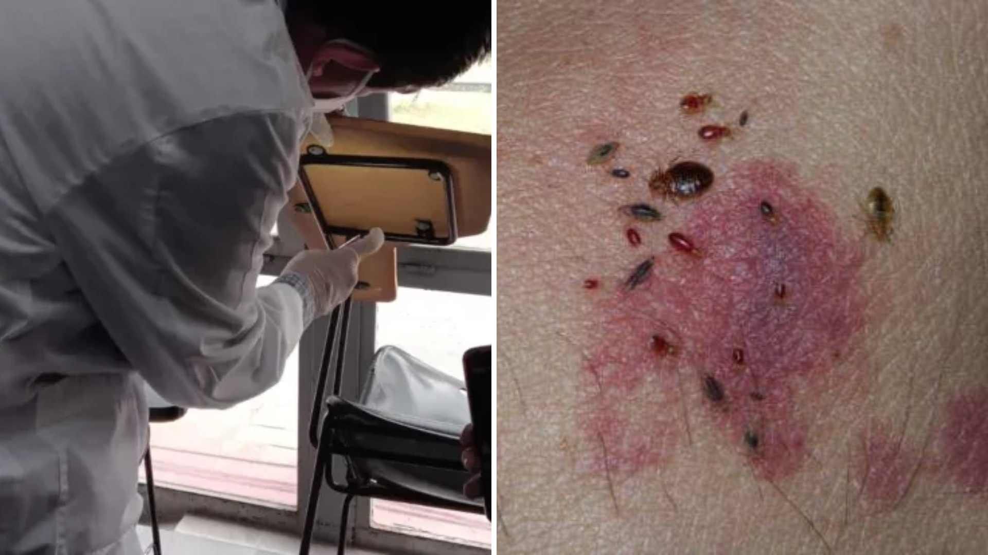 ¿Alerta Sanitaria por Chinches en CDMX? Esto Dicen las Autoridades