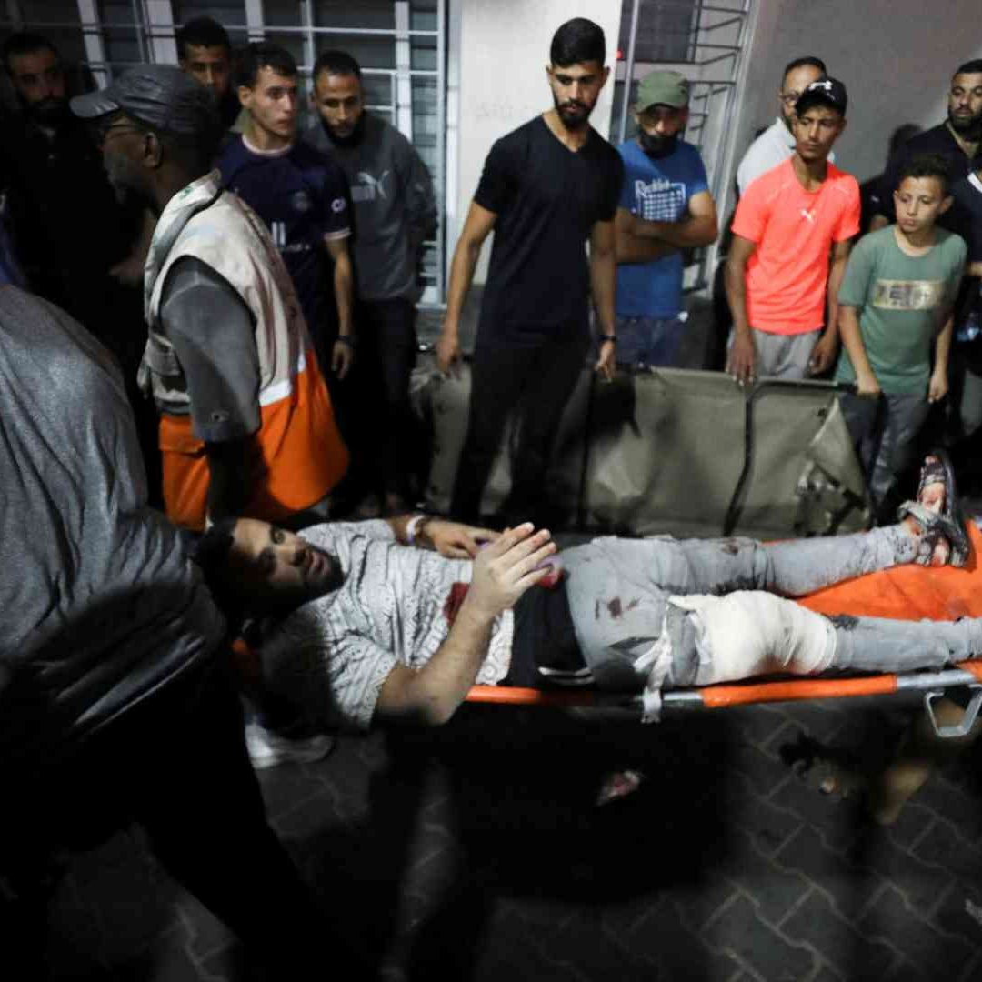 Una persona herida recibe asistencia en el Hospital Shifa después de que un ataque aéreo israelí golpeara el cercano Hospital Al-Ahli.