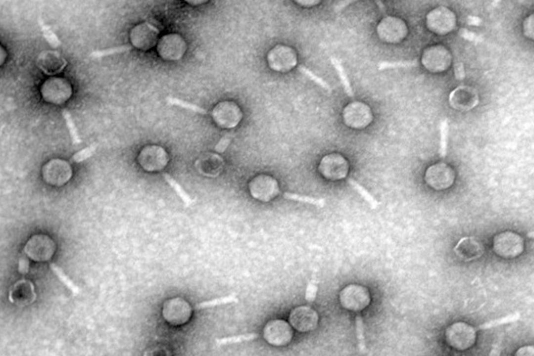 Micrografía electrónica de un virus bacteriófago