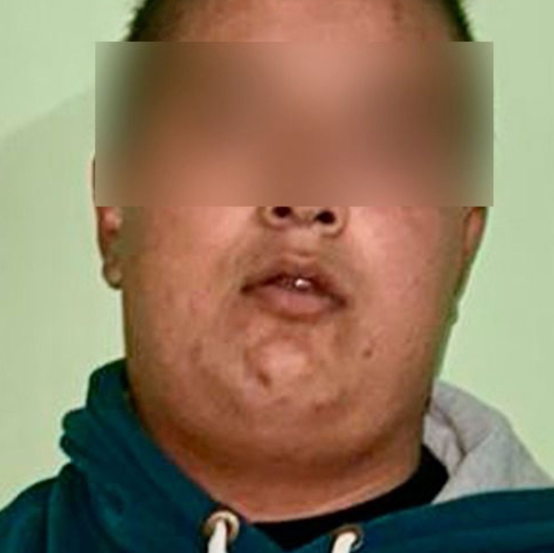 Luis N. fue liberado del CERESO de San Miguel de forma indebida.