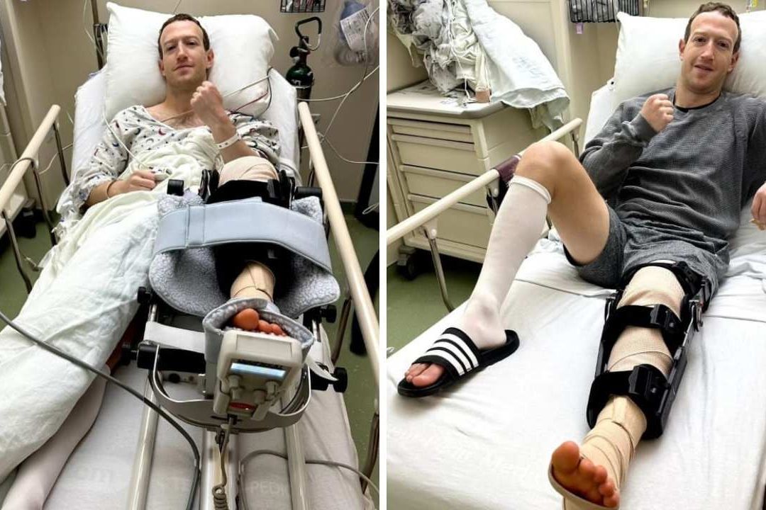 ¿Qué le Pasó a Mark Zuckerberg? Esto Se Sabe del Accidente por el que Está Hospitalizado