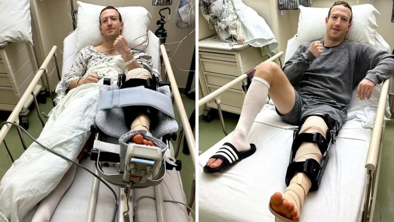 ¿Qué le Pasó a Mark Zuckerberg? Esto Se Sabe del Accidente por el que Está Hospitalizado