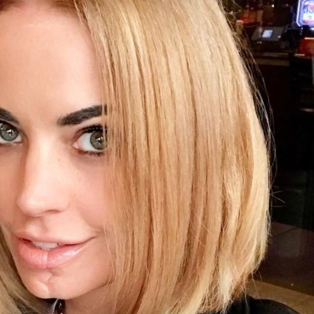 A Elly Brown le cortaron la mitad de la lengua y parte de la mandíbula. Foto: IG: realellybrown