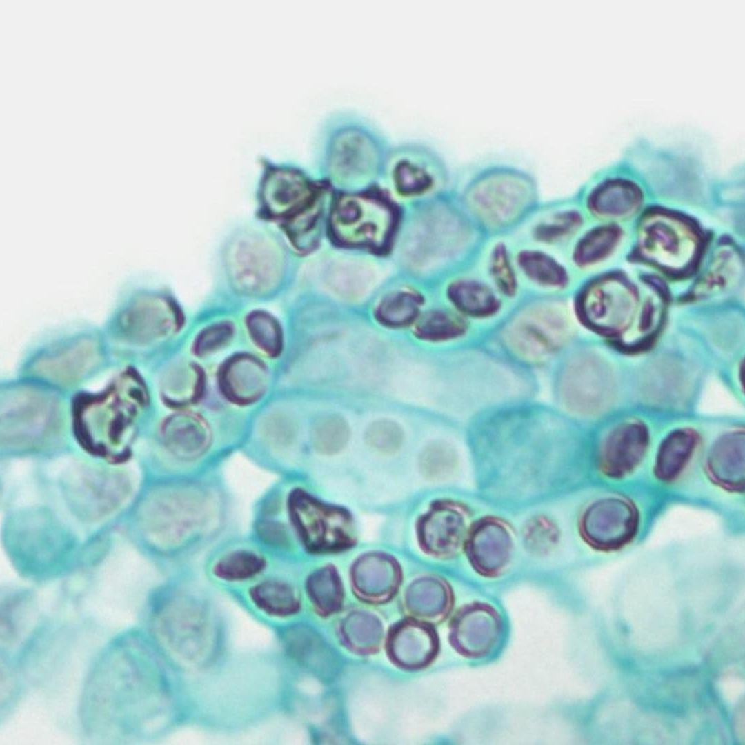 Células de levadura al reproducirse