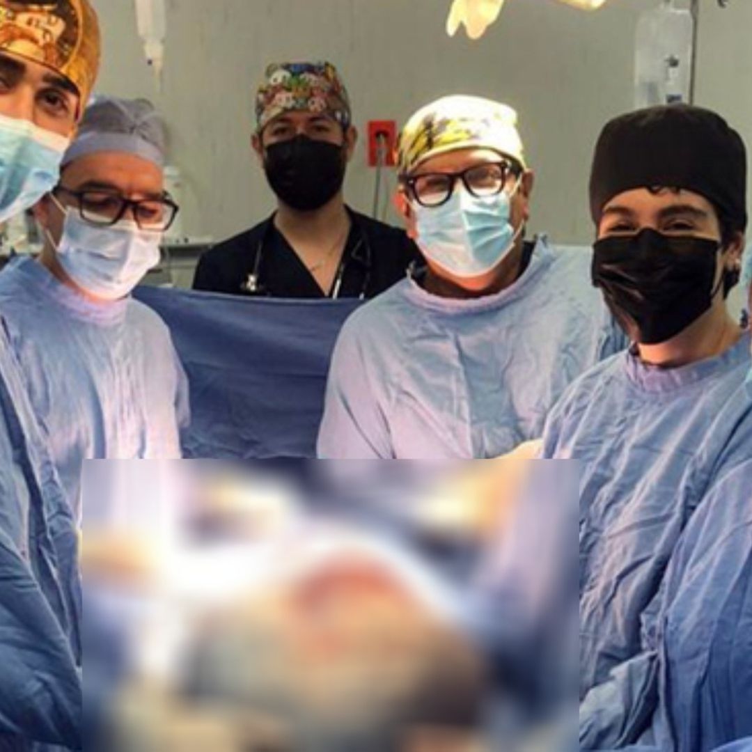 Retiran Tumor Gigante De 21 Kilos a Mujer en Guanajuato; Creía Que Eran Líquidos