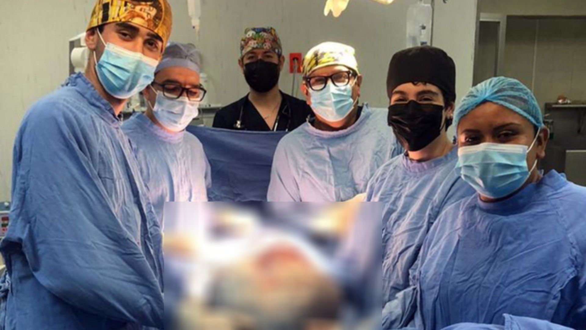 Retiran Tumor Gigante De 21 Kilos a Mujer en Guanajuato; Creía Que Eran Líquidos