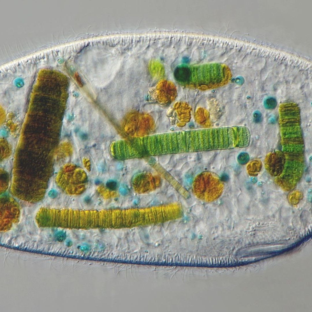 Protozoario comiendo una cianobacteria