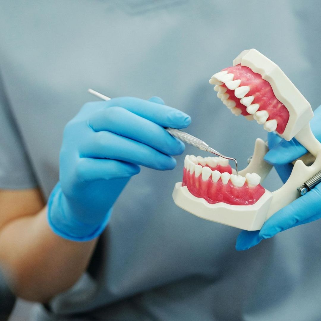 Prótesis Dentales Gratis en CDMX