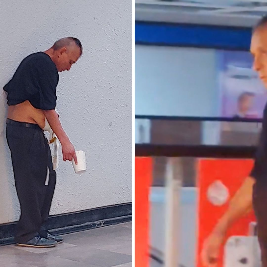 Metro CDMX: Exhiben a Hombre por Fraude con Supuesto Tumor
