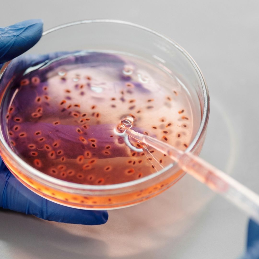 IA Identifica Nuevos Candidatos a Antibióticos contra Bacteria Resistente
