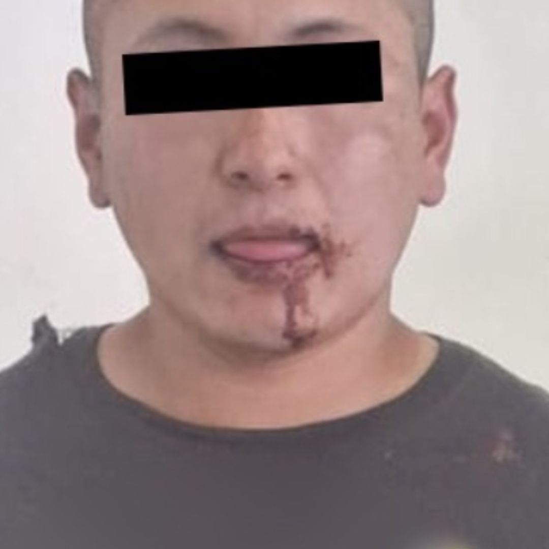 Detienen a Hombre que Acosó a una Niña Afuera del Instituto Nacional de Pediatría en CDMX