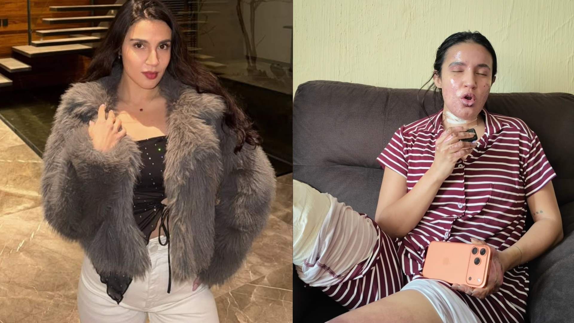 La Actriz Mexicana Patricia Valenzuela Sobrevive a Explosión en su Casa: Así Narró el Accidente