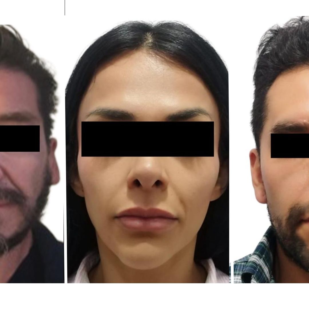 Detienen a Cirujanos Plásticos Falsos por Homicidio y Lesiones a Pacientes en Edomex