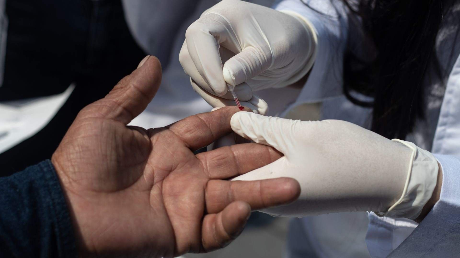 Las pruebas de VIH se realizan con muestra de sangre o saliva.